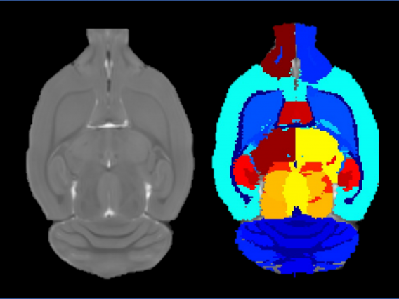 MRI Mapping card image